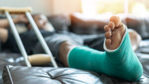 Understanding Broken Bones